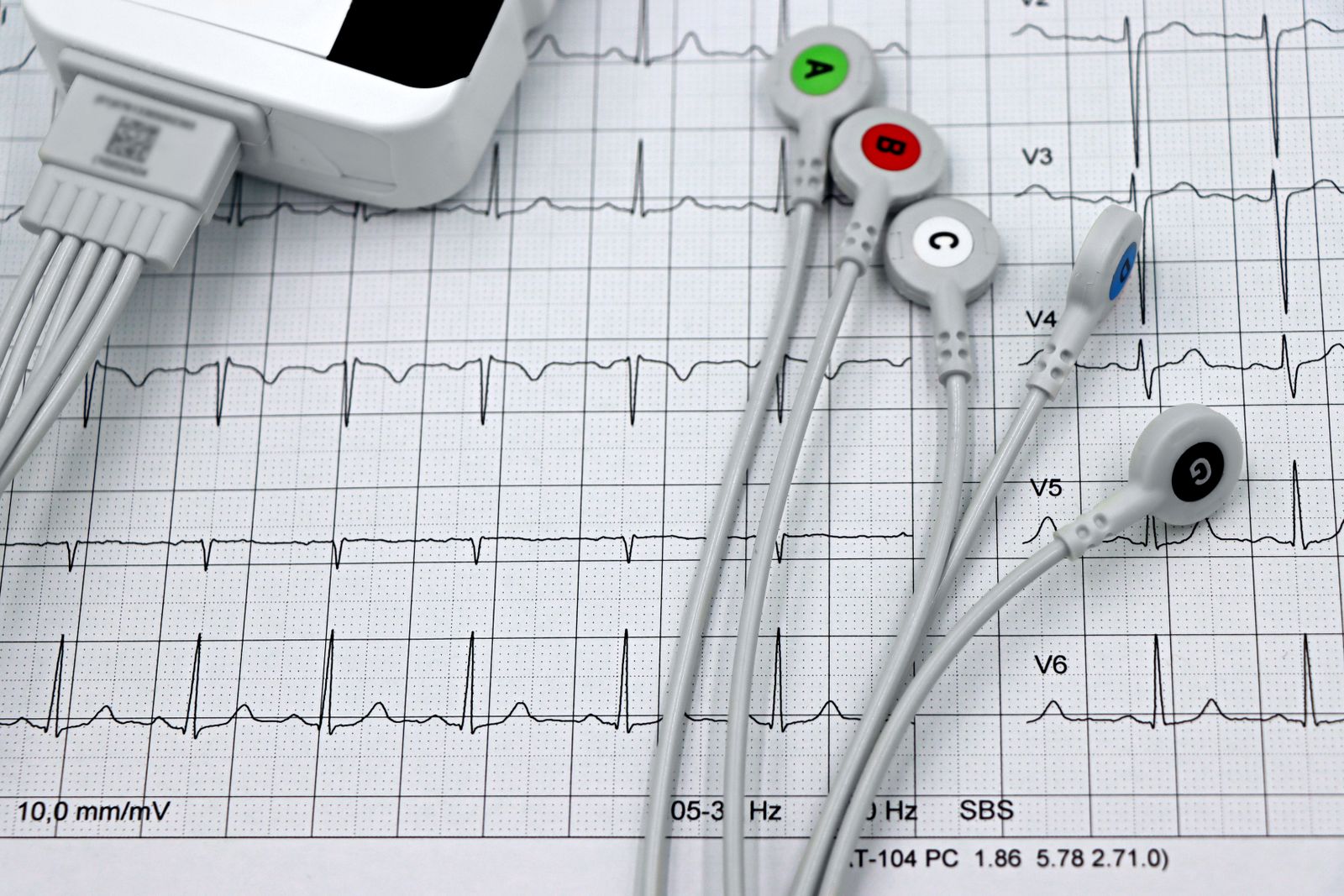 cardiologia